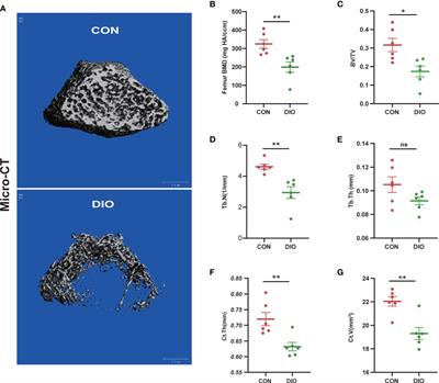 Gut microbiota and fecal metabolic signatures in rat models of disuse-induced osteoporosis